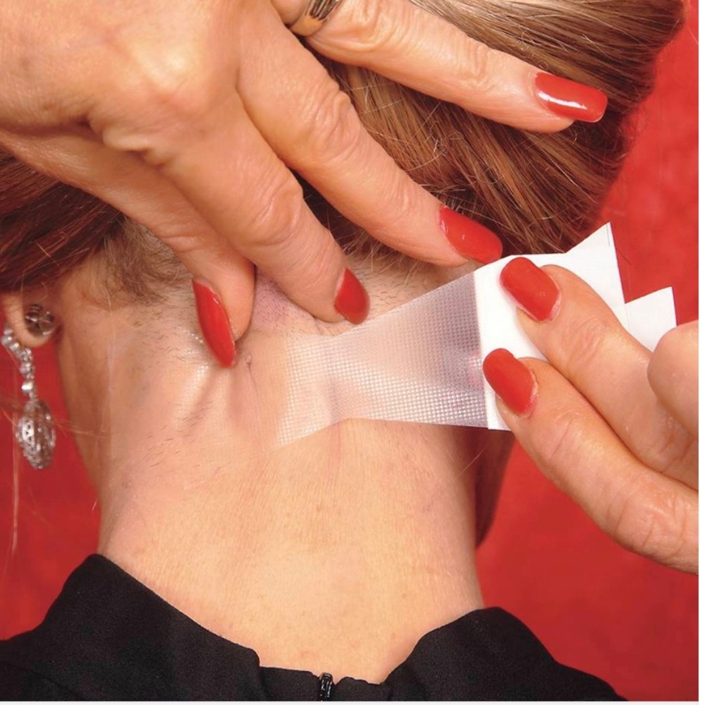 Skin options - Picture 4 of 5